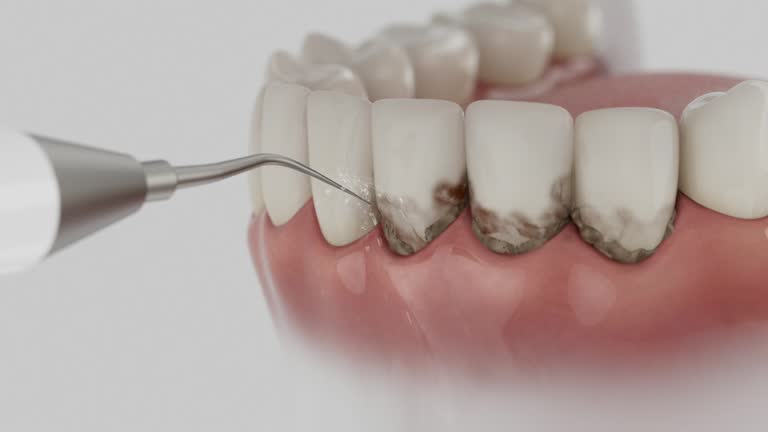 Trusted Root Canal Treatment service in Choctaw Lake, OH - Dentist Open Now